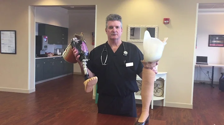Dr. Kenneth Mook on Amputee Rehabilitation | Gatew...