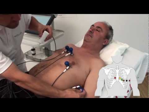 SCHILLER electrode placement for resting ECG with standard electrode set