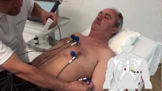 SCHILLER electrode placement for resting ECG with standard electrode set