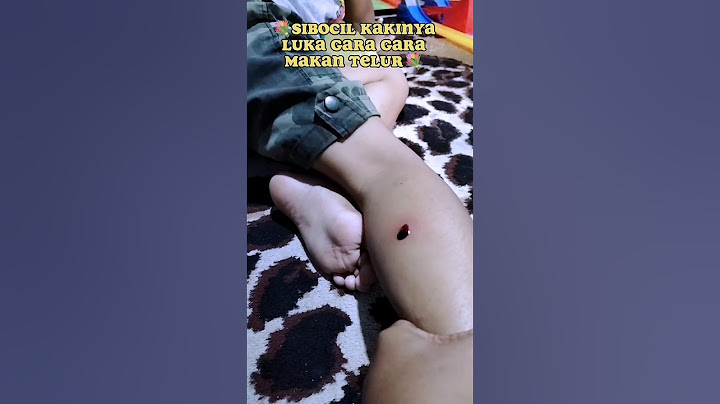 Sibocil kakinya luka gara gara kebanyakan makan telur_Mama & agra#badut #eskrim #mainan #hantu #yupi