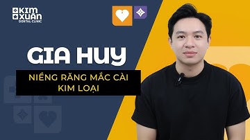 Từ răng hô, chen chúc, thưa răng… đến nụ cười hoàn hảo sau 2 năm #dentist #nhakhoa #niengrang