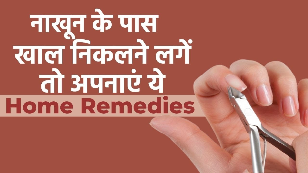 नाखून में फंगल इंफेक्शन के घरेलू उपाय - Home remedies for toe nail fungus  in Hindi