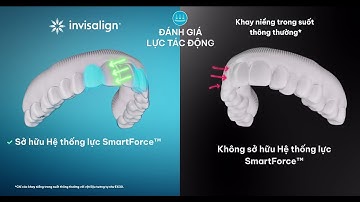 INVISALIGN – 5 Tiêu Chí Làm Nên Sự Vượt Trội