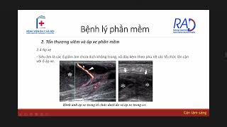 SIÊU ÂM CƠ QUAN VẬN ĐỘNG | BS. NGUYỆT screenshot 4