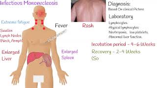 EpsteinBarr virus  and Infectious Mononucleosis symptoms and treatment