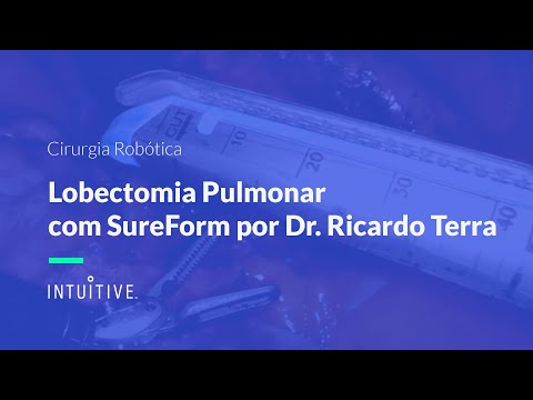 Cirurgia Robótica – Lobectomia Pulmonar com SureForm – Dr. Ricardo Terra