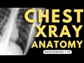 Chest xray anatomy  radiology anatomy part 1 prep  how to interpret a chest xray