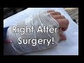 BASAL JOINT ARTHRITIS - AFTER SURGERY ON SURGERY DAY