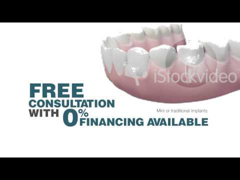 AGD Dental Implants1 Preview