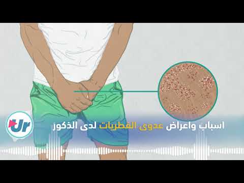 اسباب واعراض عدوى الفطريات لدى الذكور