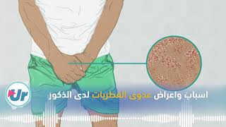 اسباب واعراض عدوى الفطريات لدى الذكور