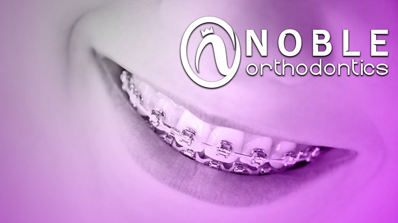 Noble Orthodontics - Order Orthodontic Supplies Online