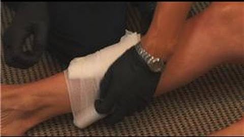 Emergency Medical Care : How to Treat an Open Fracture During First Aid