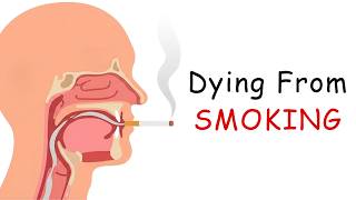What Dying from Smoking Feels Like