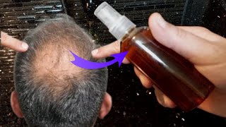 Saçlar deli gibi uzuyor ve dökülmüyor! En iyi çare bu! Sadece 3 güçlü malzeme.