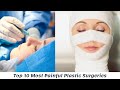 Top 10 Most Painful Plastic Surgeries - Most Top 10