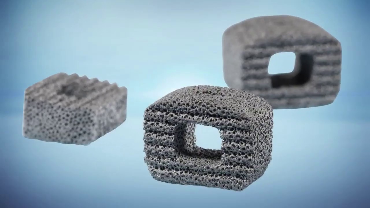 Trabecular Metal Material video phone beyonce mp3