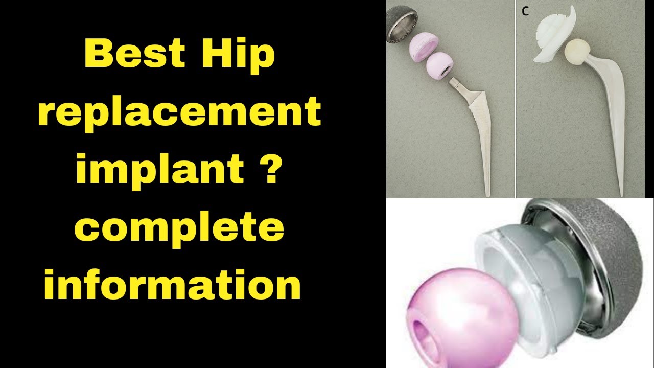 hip replacement me kya kya use hota hai hindi me complete information