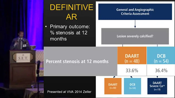 Advanced Atherectomy Device: Indications and Evidence