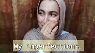 MY PERFECT IMPERFECTIONS | كل عيوبي في فيديو واحد