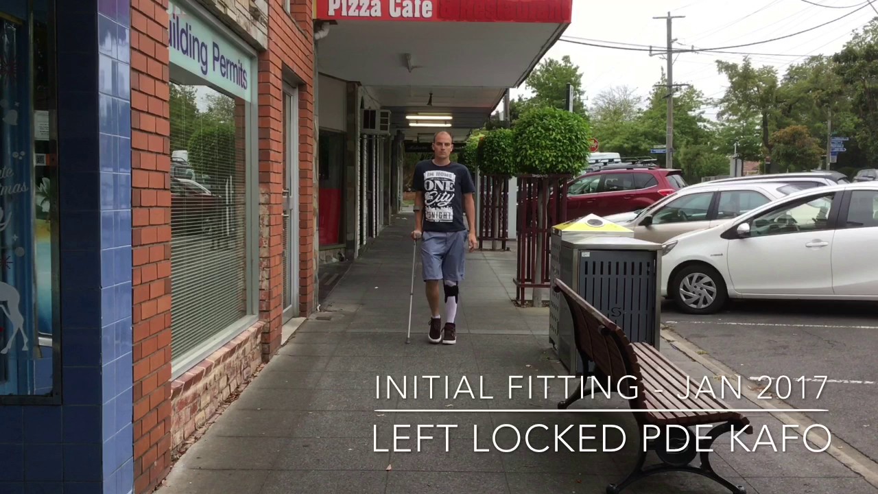 Left Leg Paralysis - PDE Locked KAFO