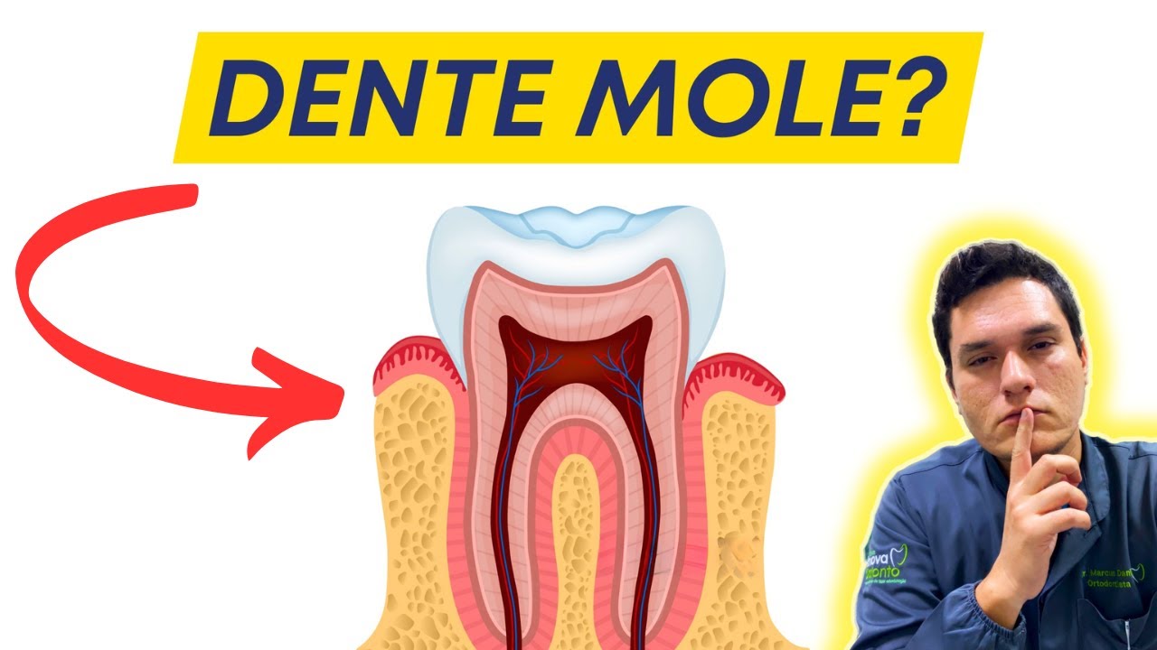 DENTE MOLE: 4 CAUSAS COMUNS E O QUE FAZER? - YouTube