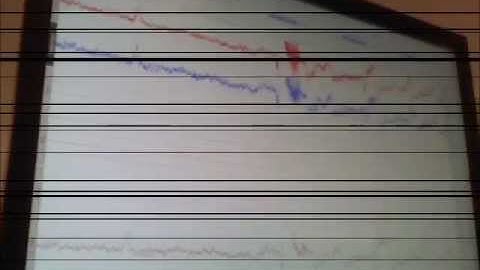 P457 EEG artifact informational video