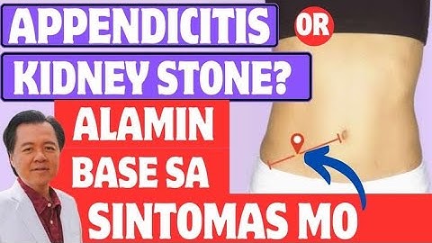 Appendicitis or Kidney Stone? - By Doc Willie Ong (Internist and Cardiologist)