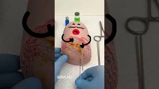 Thumbnail for Goodland | Operation on sausage, cut off head 😂 #goodland #Fruitsurgery #doodles #doodlesart