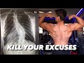 Kill Your Excuses - Scoliosis Warrior