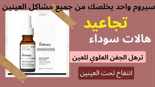 the ordinary  اخييرا احسن سيروم ف2023 لعلاج جميع مشاكل محيط العينين