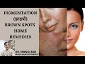 HOW TO REMOVE PIGMENTATION / FRECKLES / BROWN SPOTS / MELASMA I DR. MANOJ DAS