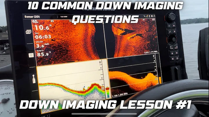 10 Common Down Imaging Questions Answered