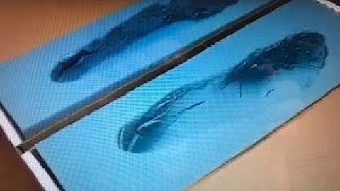 How I Mold For Custom Orthotics