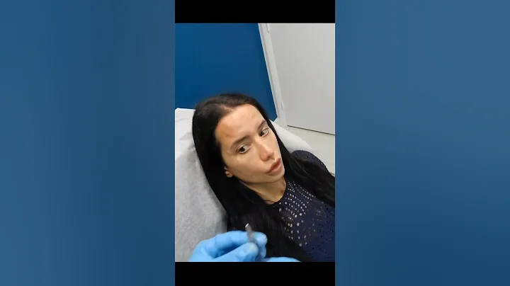 Daxxify: The Future of Wrinkle Treatment Unveiled | Everything You Need to Know #shorts  #botox