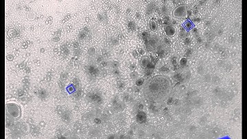 Demonstration Video for "Artificial Defocus for Displaying Markers in Microscopy Z-Stacks"