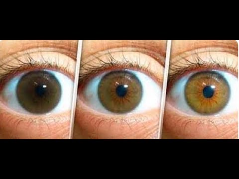 Clearing Cataracts, Dry Eye And Floaters