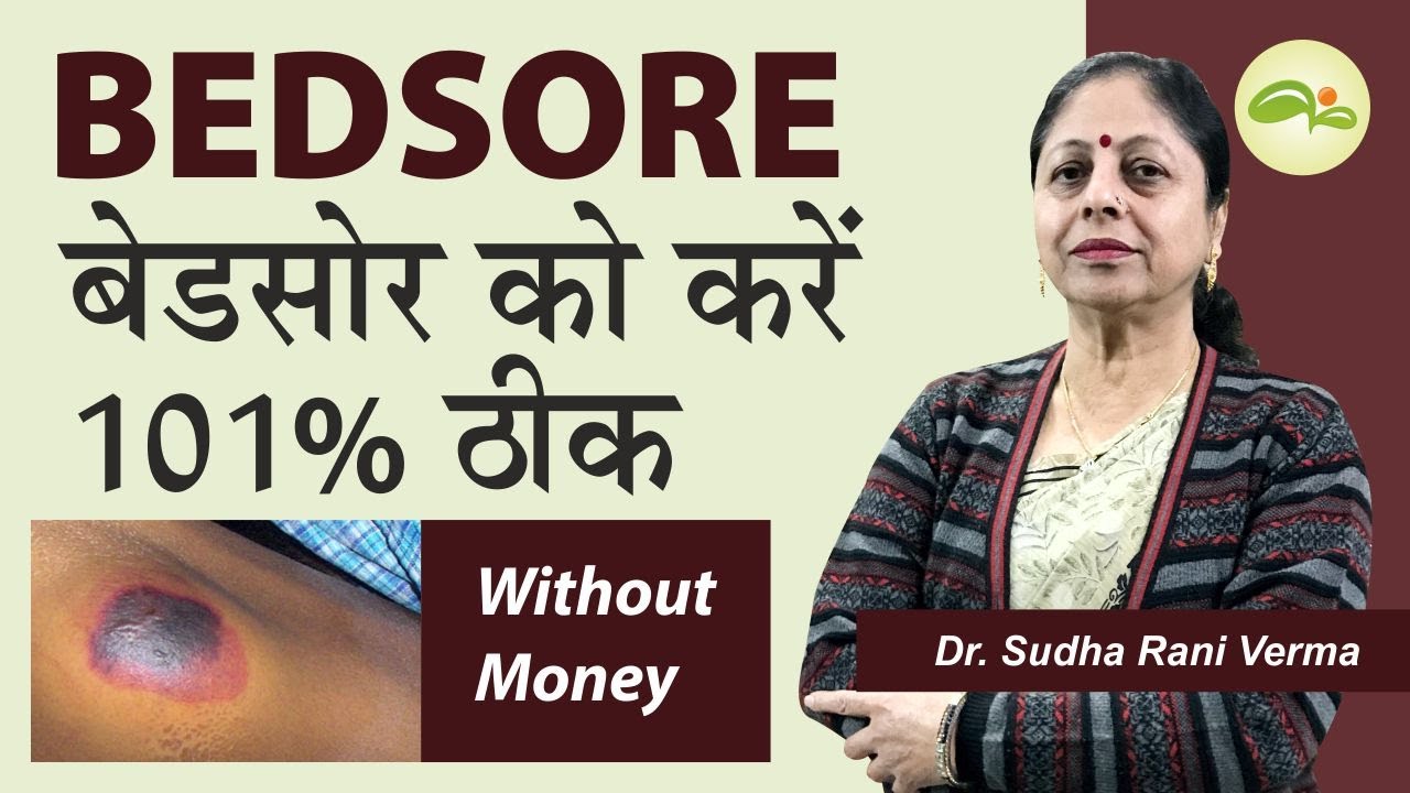 Bedsore Treatment बेड सोर का इलाज कैसे करें Pressure Ulcer How to