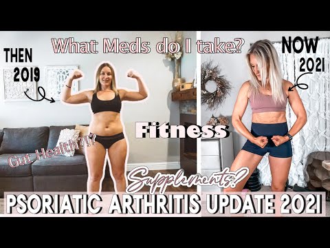 PSORIATIC ARTHRITIS & SIBO UPDATE 2021!! Symptoms, Supplements & Meds!! I feel SOOO much better!!!