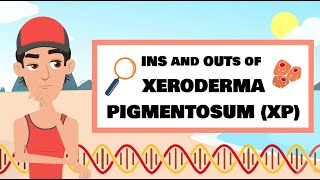 The Ins and Outs of XP (Xeroderma pigmentosum)