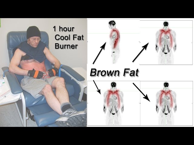 Thyroid problem causes weight loss Will thyroid problem causes weight loss diet book