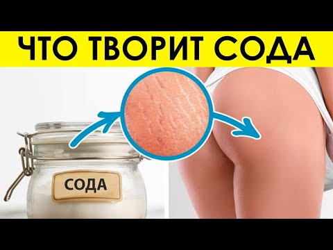 Пищевая Сода: Польза и Вред Для Организма. Необычные Способы Применения, о Которых Мало Кто Знает