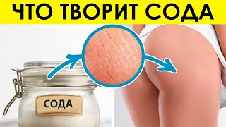 Пищевая Сода: Польза и Вред Для Организма. Необычные Способы Применения, о Которых Мало Кто Знает