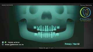 1 1  Sequence Of Teeth Eruption 8534843 237629812