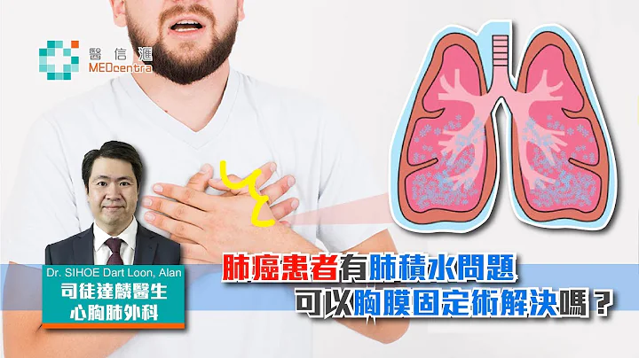 【心胸肺診症室】肺癌患者有肺積水問題可以胸膜固定術解決嗎?｜司徒達麟醫生 - 天天要聞