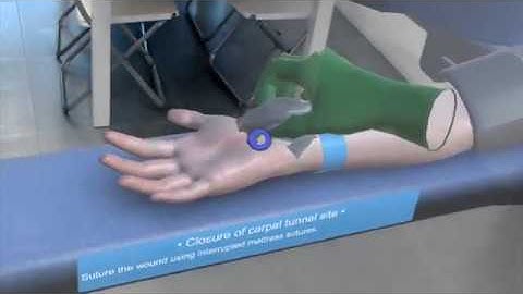 Augmented Reality Solutions with Touch Surgery