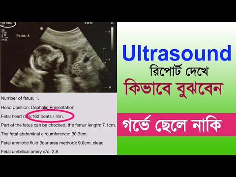 ভিডিও: আপনার ছেলে বা মেয়ে আছে কিনা শিশুরা কি বুঝতে পারে?