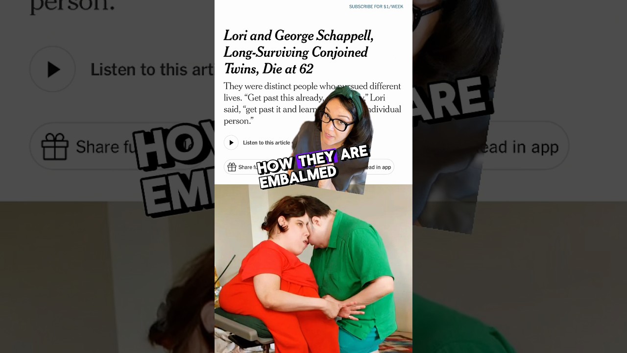 Embalming CONJOINED TWINS explained! 