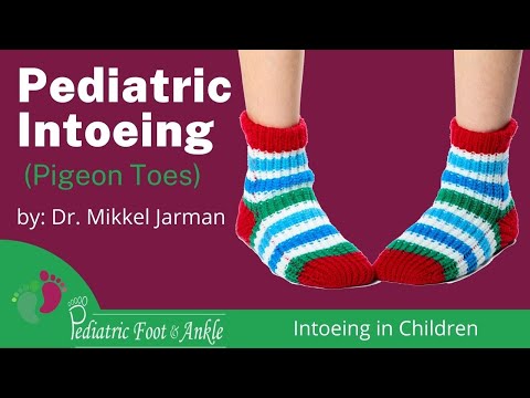 Pediatric Intoeing (Pigeon Toes) Intoeing in Children