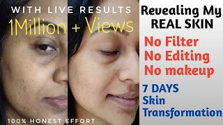 Revealing my REAL Skin Transformation | Recordings for 7 days with Live Results | No pigmentation